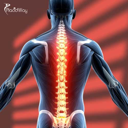 Rise Beyond Limits: Spinal Cord Injury Stem Cell Therapy in Malaysia Giving Hope to Patients from India